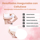Masajeador anticelulítico 5 en 1 CelluEase® - OptiGoods™